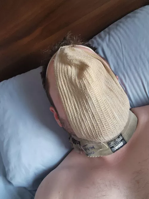 Face by Chemical-Ant-8106