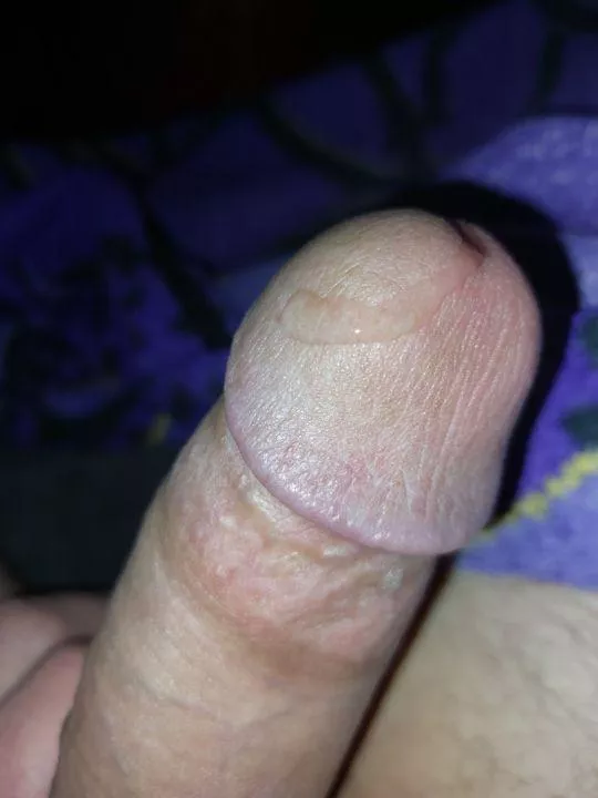 Leaking feels so good posted by funguy777777777