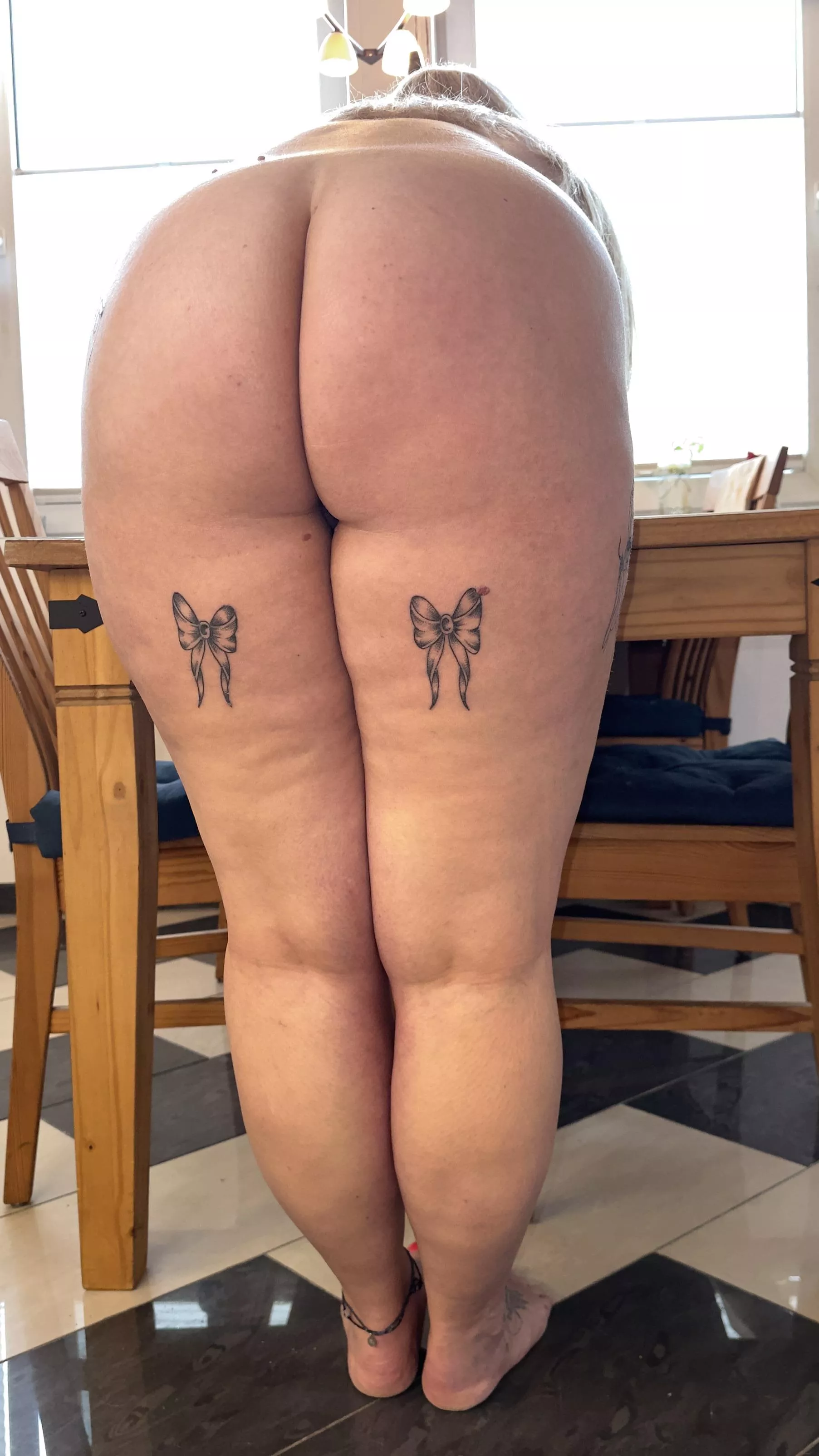 my cellulite are shining posted by ArchilusIV