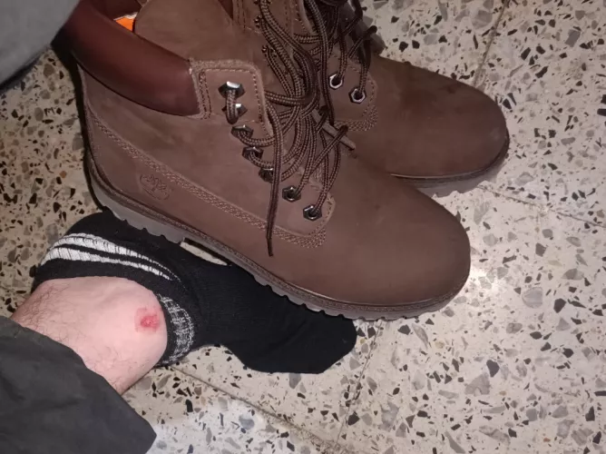 Side ankle blisters  by censored_996