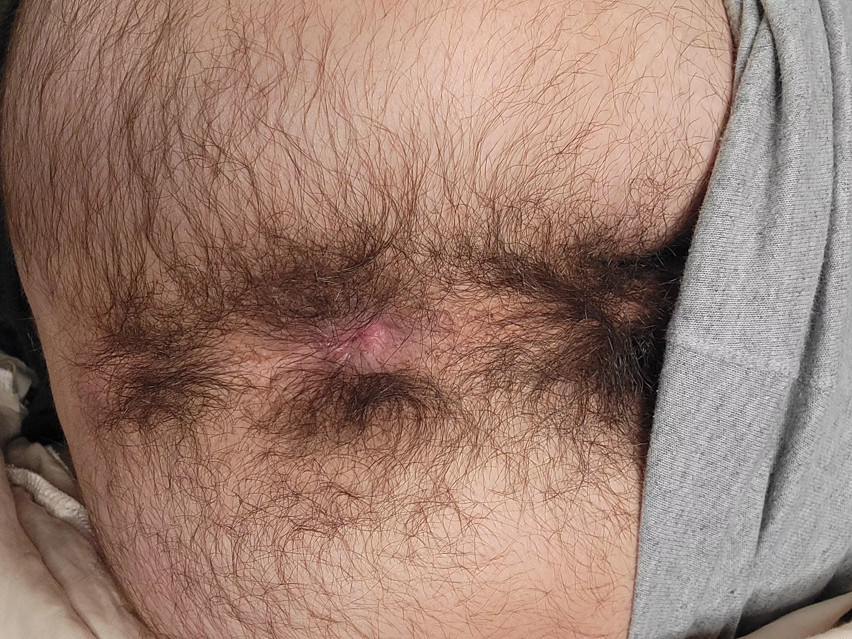 Hairy boy hole posted by apollograyofcl