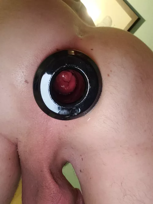 Tunnel plug for the win  by Substantial-Bid4116