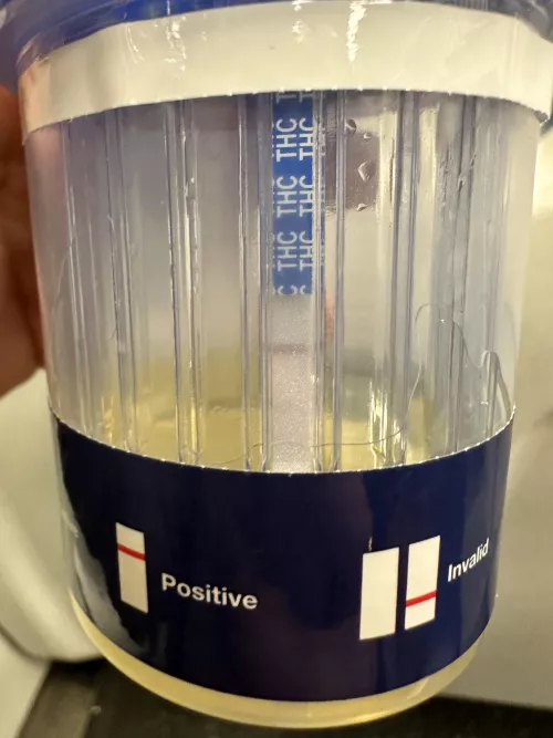 Does you see a second faint line indicating that this test is negative by FuzzyImagination9370