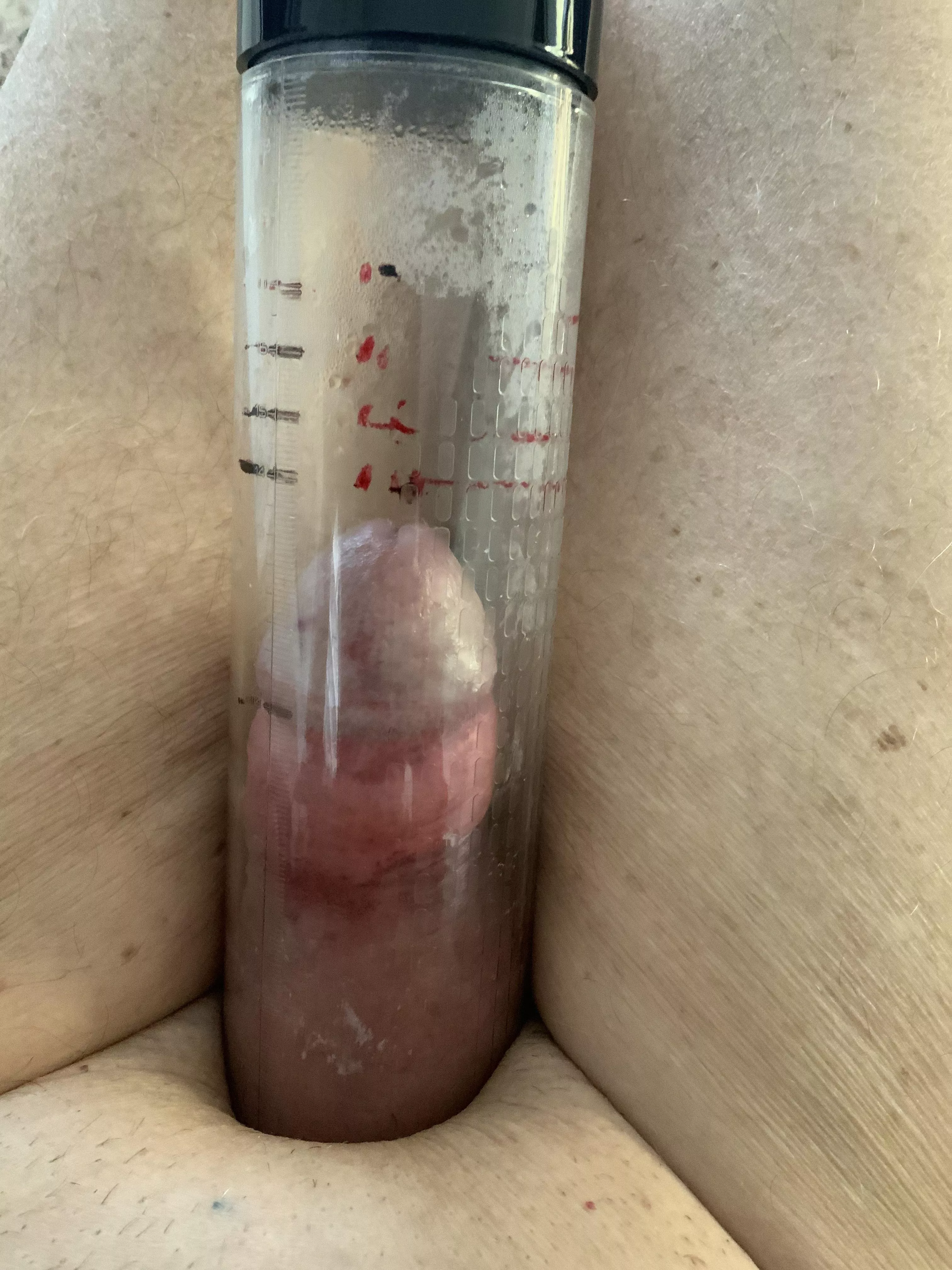 Just started  posted by Ecstatic_Brief_1183