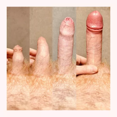 Too much forwskin? by Hailey_Washington85