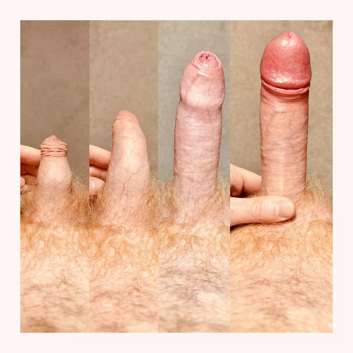 Too much forwskin? posted by Hailey_Washington85