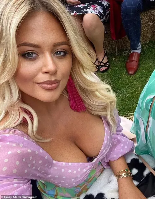 Emily Atack  by Any-Celebration-6655