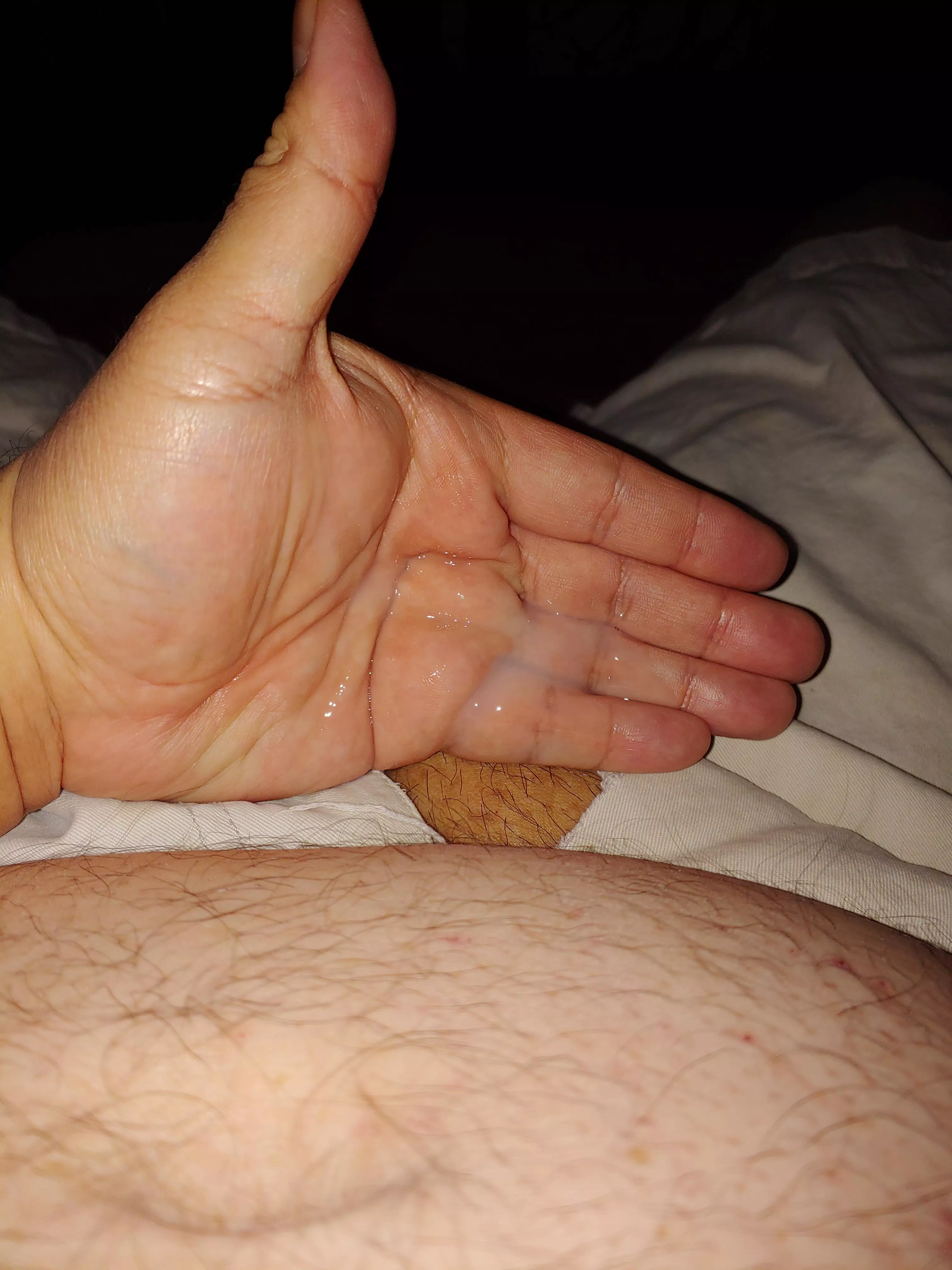 Help me clean my hand? posted by Biguychub