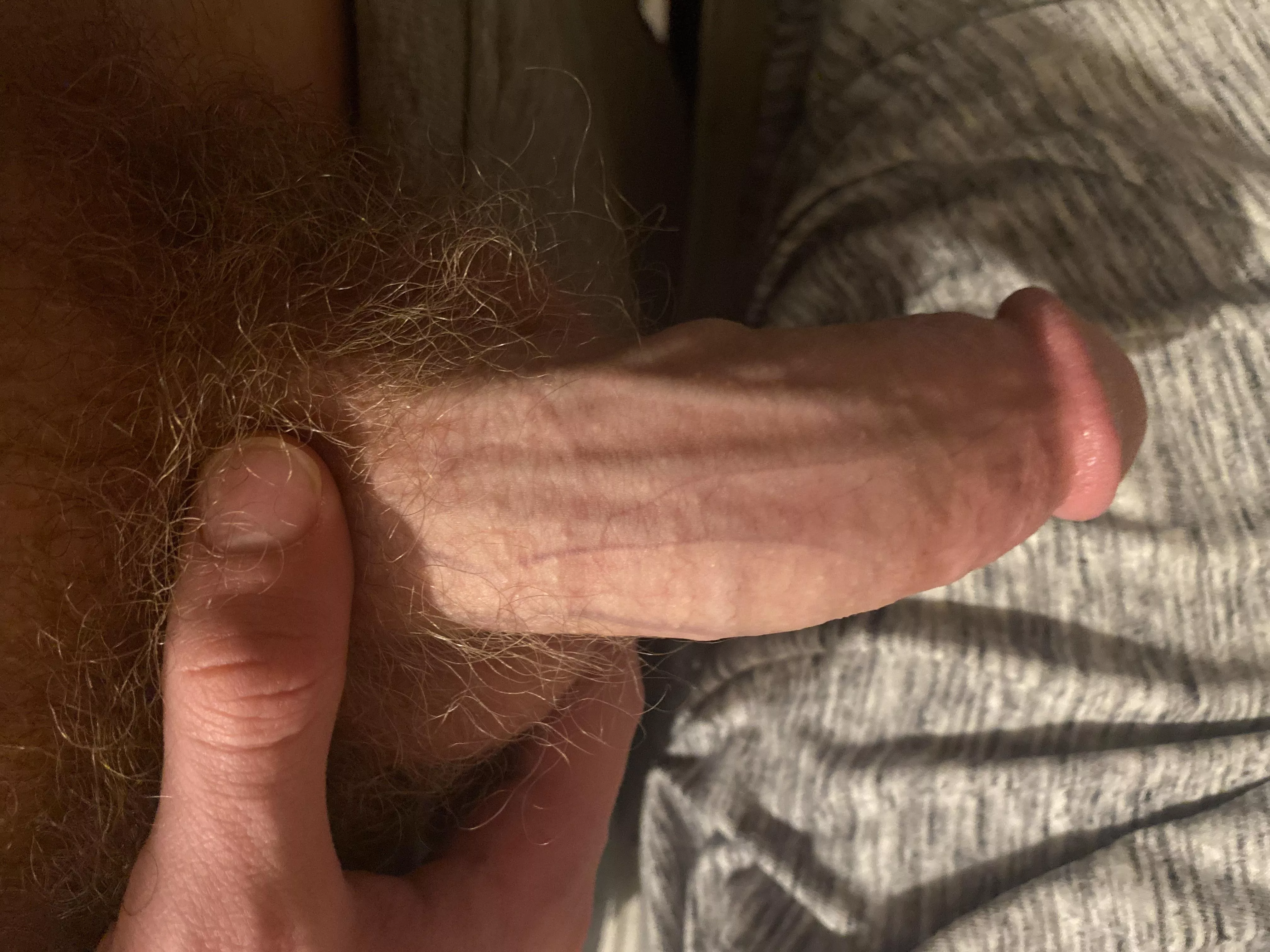 veins posted by Mike336643