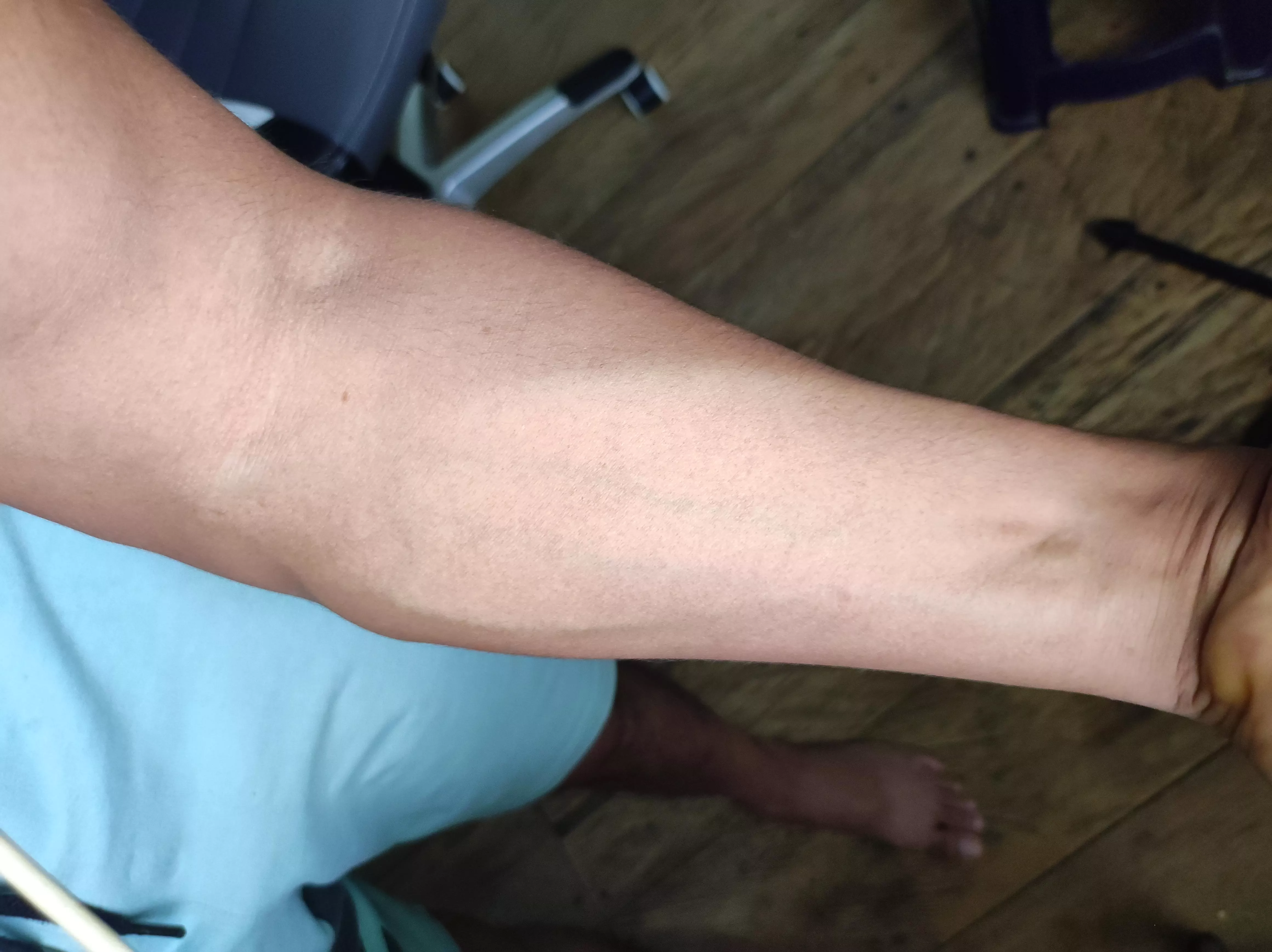 A good forearm squeeze  posted by gonzalo_hillary