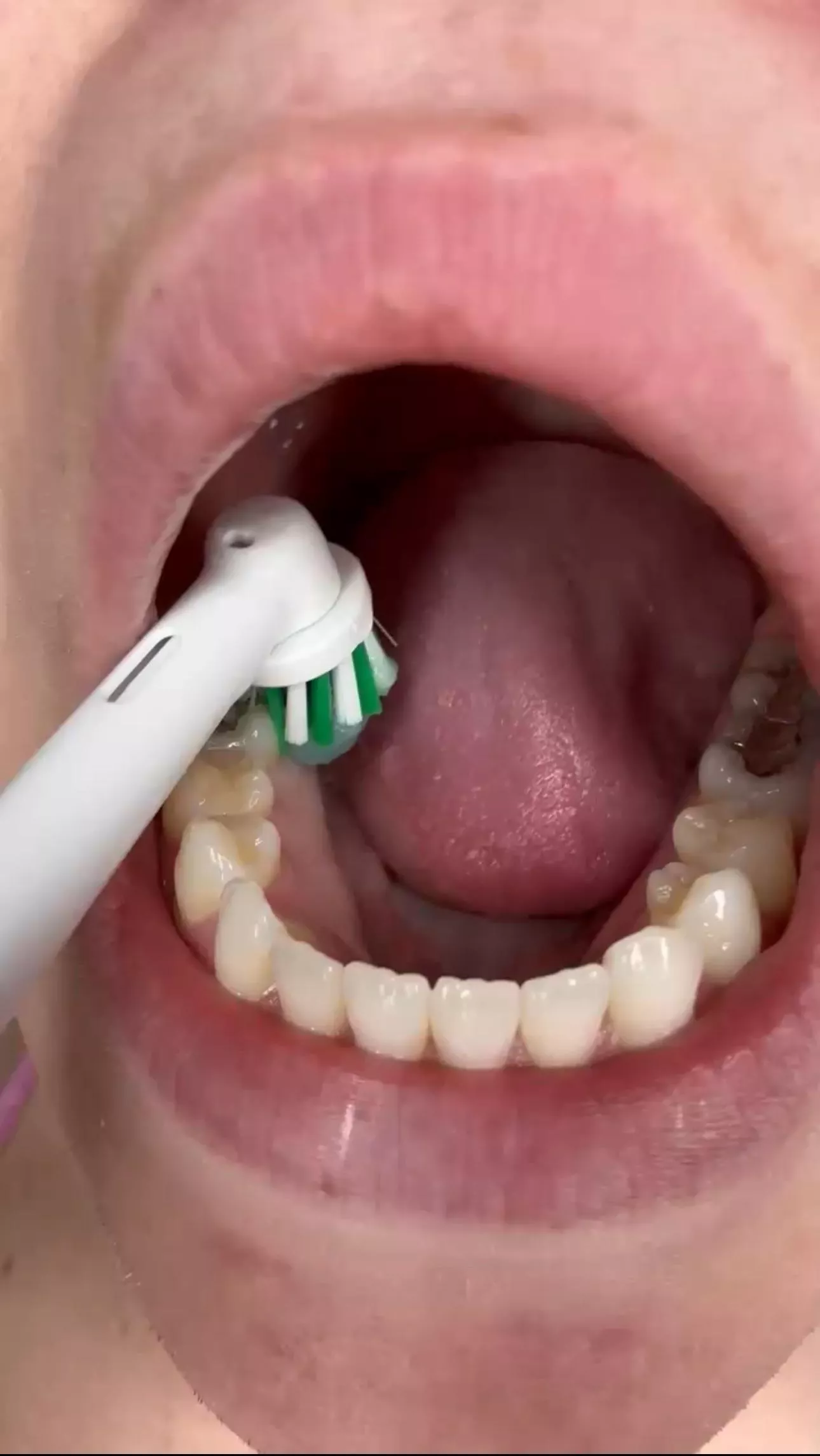 Anyone have a mouth or dental fetish?  posted by Own-Dust-8208