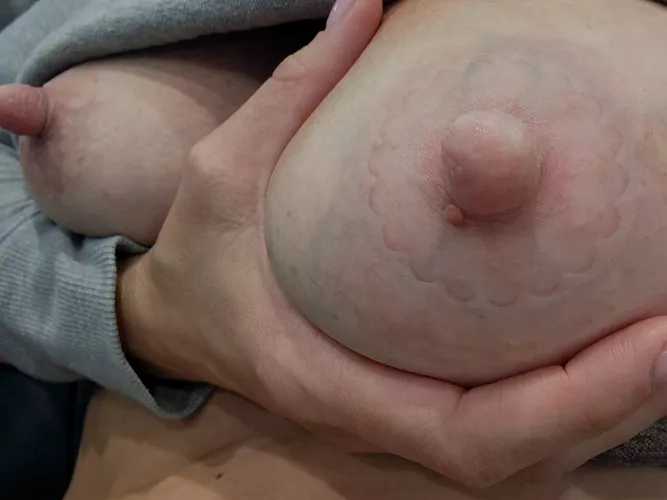 Engorged and lopsided  by PippasMommyDiary