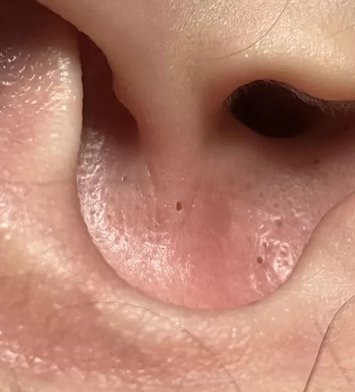 Remembered this hole i left in my friend’s ear by Kitniponcrack