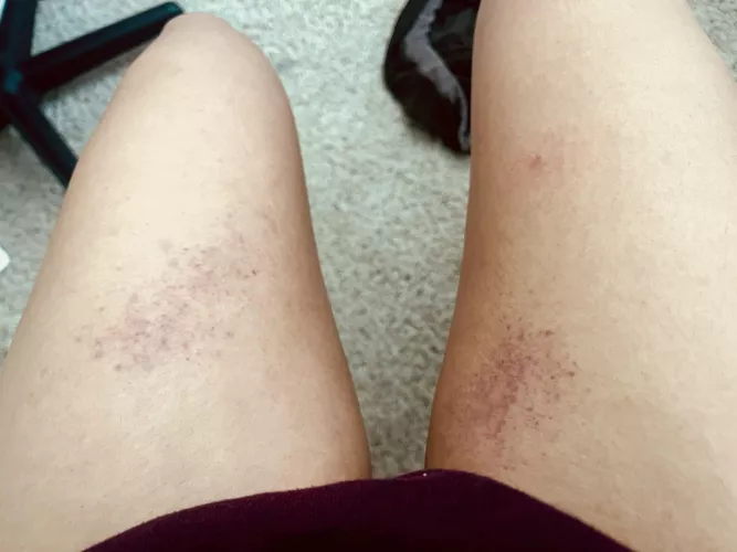 A little thigh spanking by japandandelion