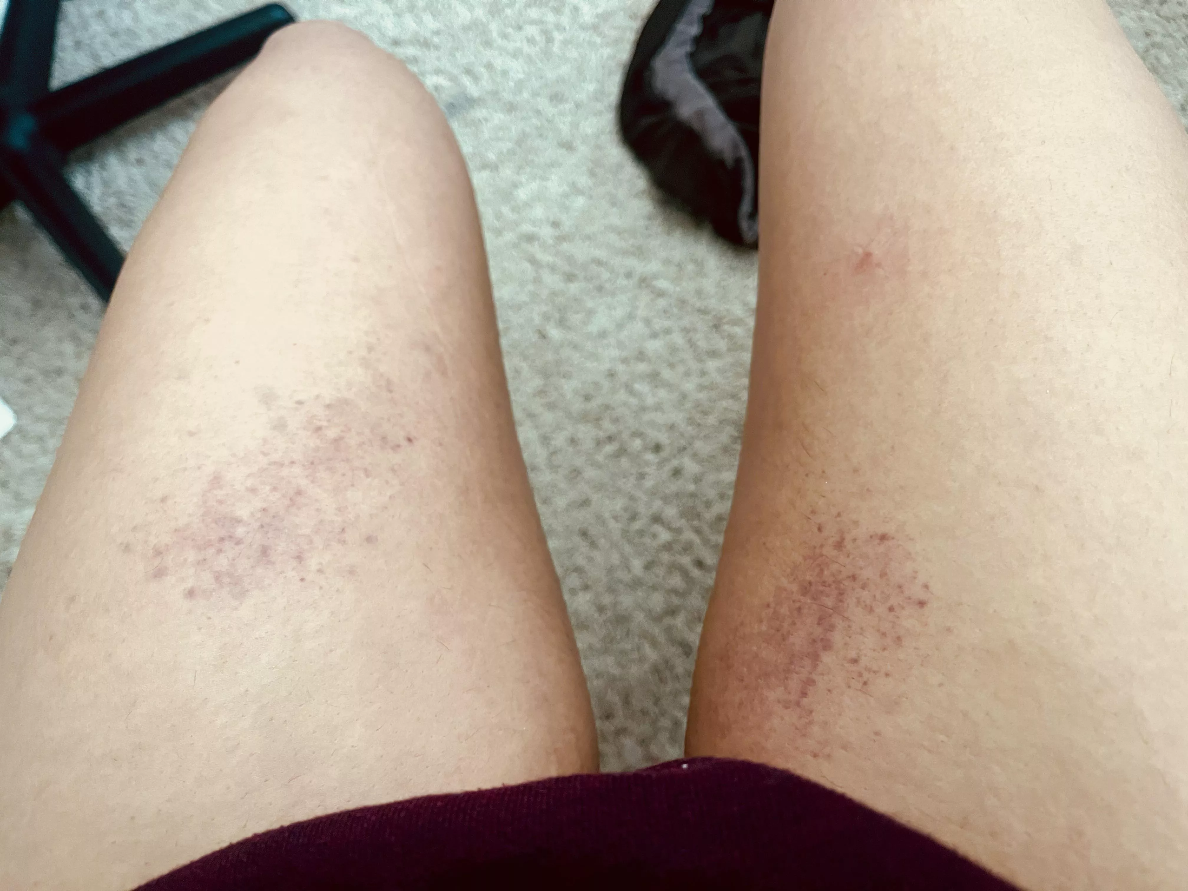 A little thigh spanking posted by japandandelion