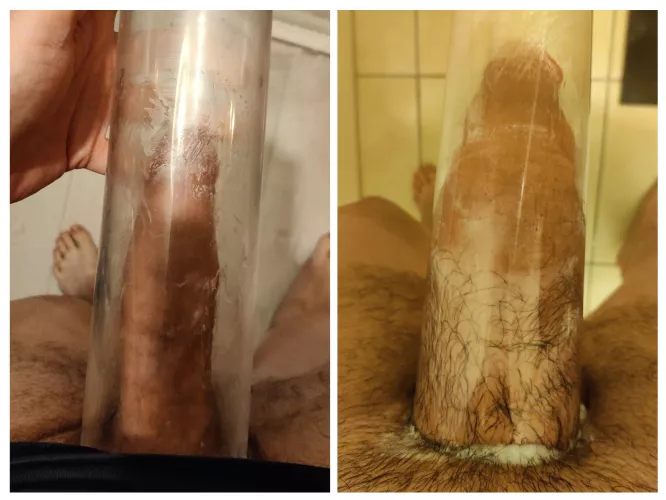 Before & After by chrizpy89