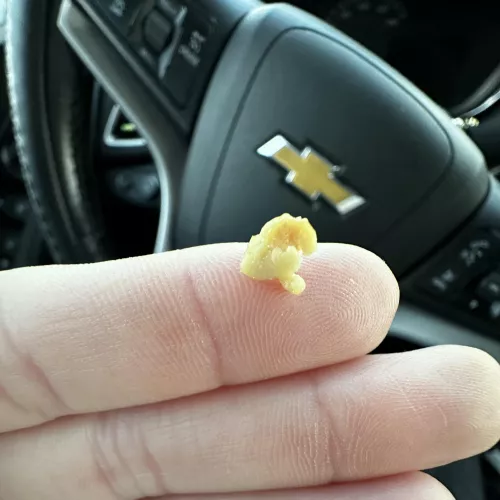 Coughed this up this morning by frankie0013