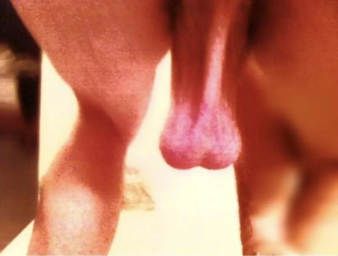 Torture and abuse these posted by Aimlesssmithling1996