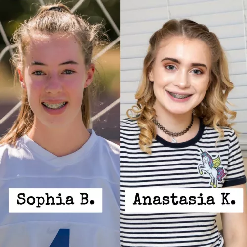 Which brace face would you glaze? [2] by Mysterious-Phrase885