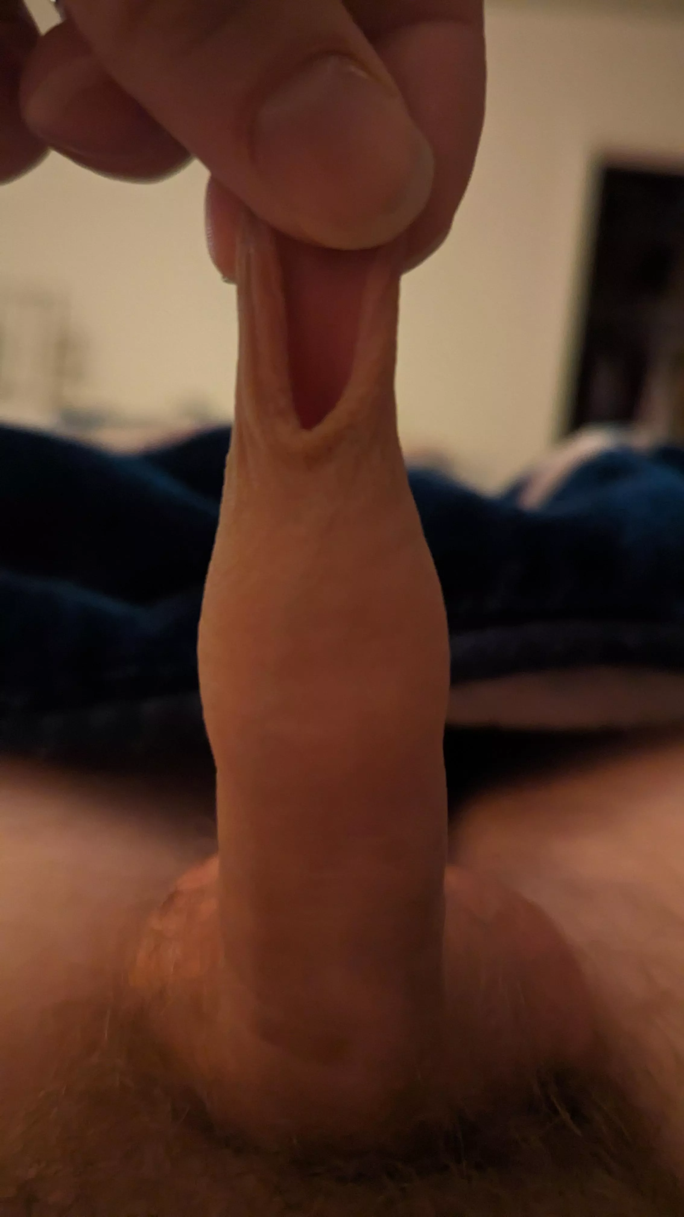 Anyone else like stretching thier  skin out for no reason?  posted by No-Section-2258