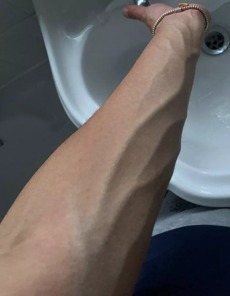 Veins Coming To Play posted by MixtureKey5243