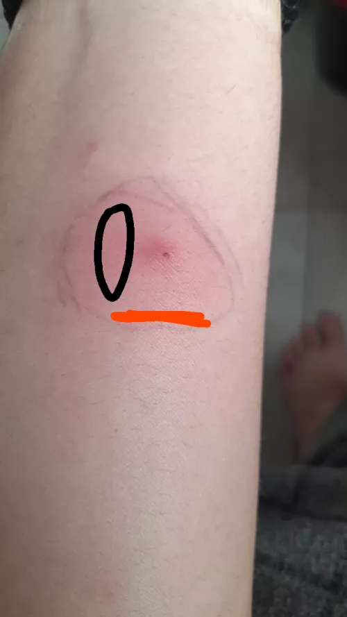 What is this?, should i be worried by D34TH_D4RK