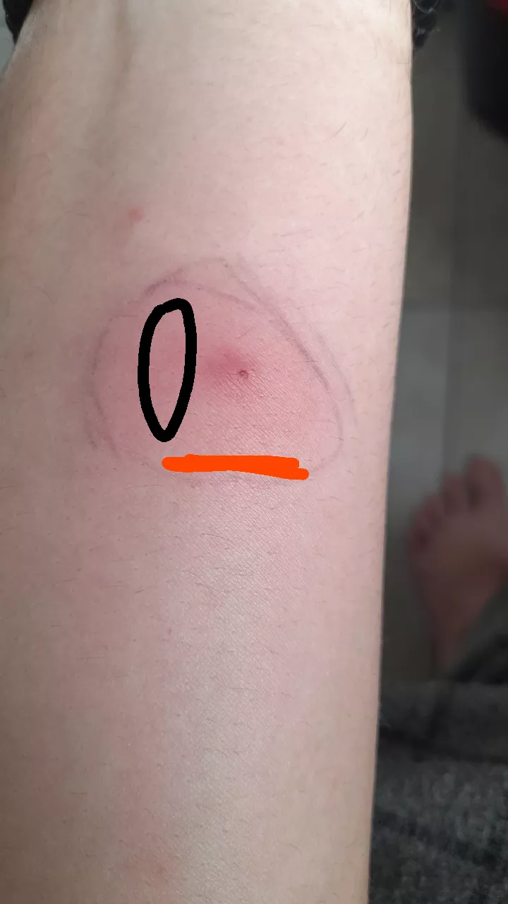 What is this?, should i be worried posted by D34TH_D4RK