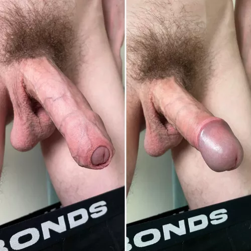 Best of both worlds 🙈🙉 by aesthed1ck