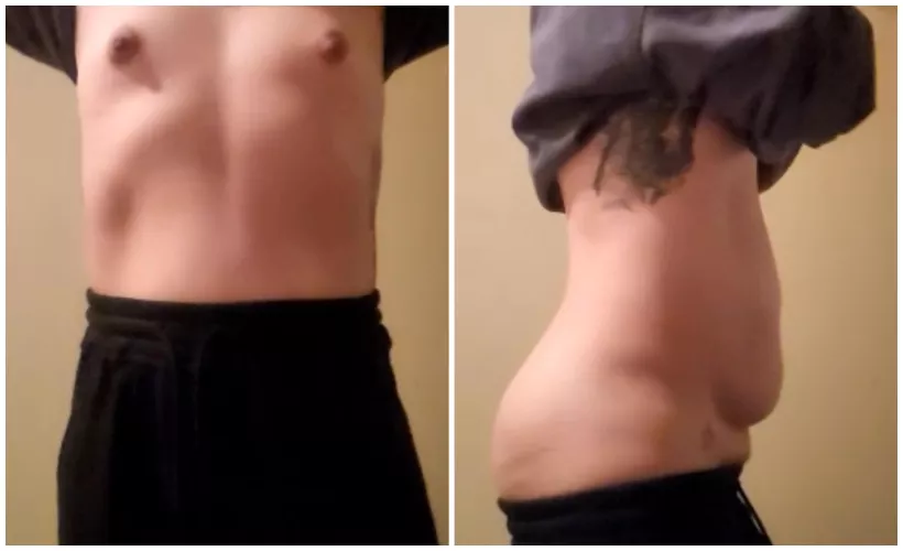 For the life of me I cannot decide if i want to lose weight and get my sporty bod back or indulge the curves and get chubbier 😭 by Brujabimbo