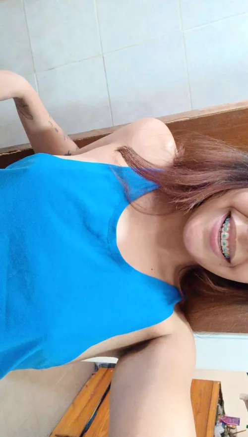 My braces want to get your attention, but you're seeing something else  by rossweetie_