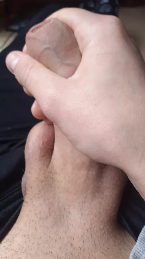 Come help me with my self facials! by BarracudaExcellent29