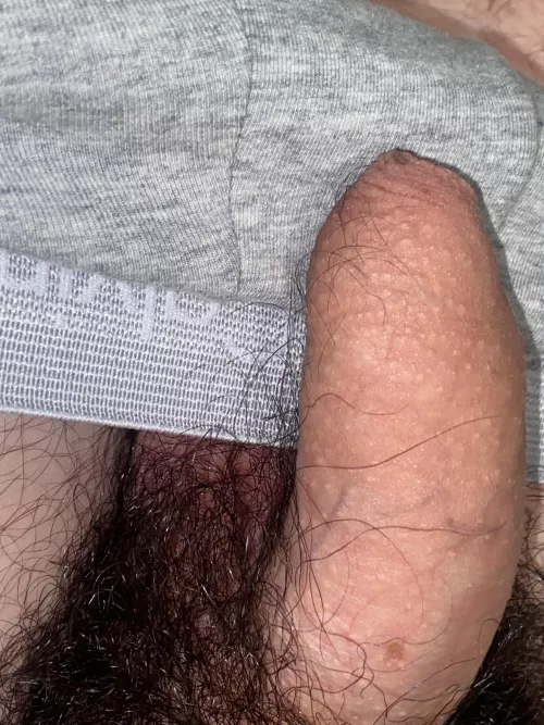 I get some hairs in my foreskin... is it common? Comments are really welcome  by andy990aaa90