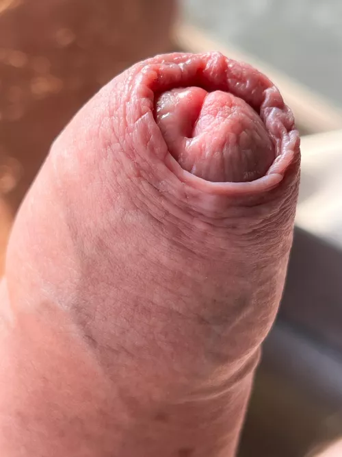 Loving my skin by coffeeguy04