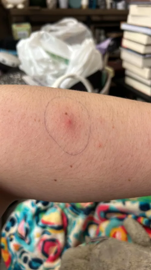 Now.. The Waiting Game  by ThatArtisticMoose