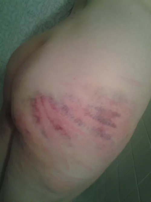 [F] Throwback to my first BDSM spanking scene ever. I was so excited to finally try it! by kinkycalfriends