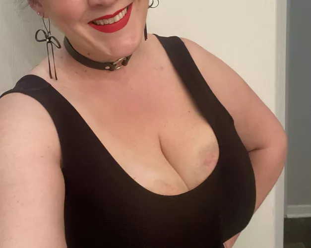 I love showing off my bruises! by LHOOQ42