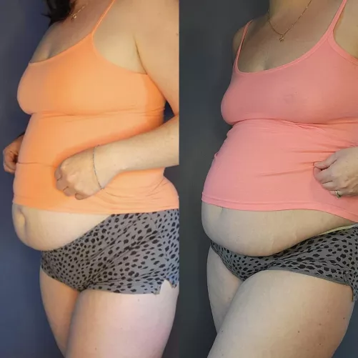 I've definitely been stuffing myself well😅 by Executiveassistant00