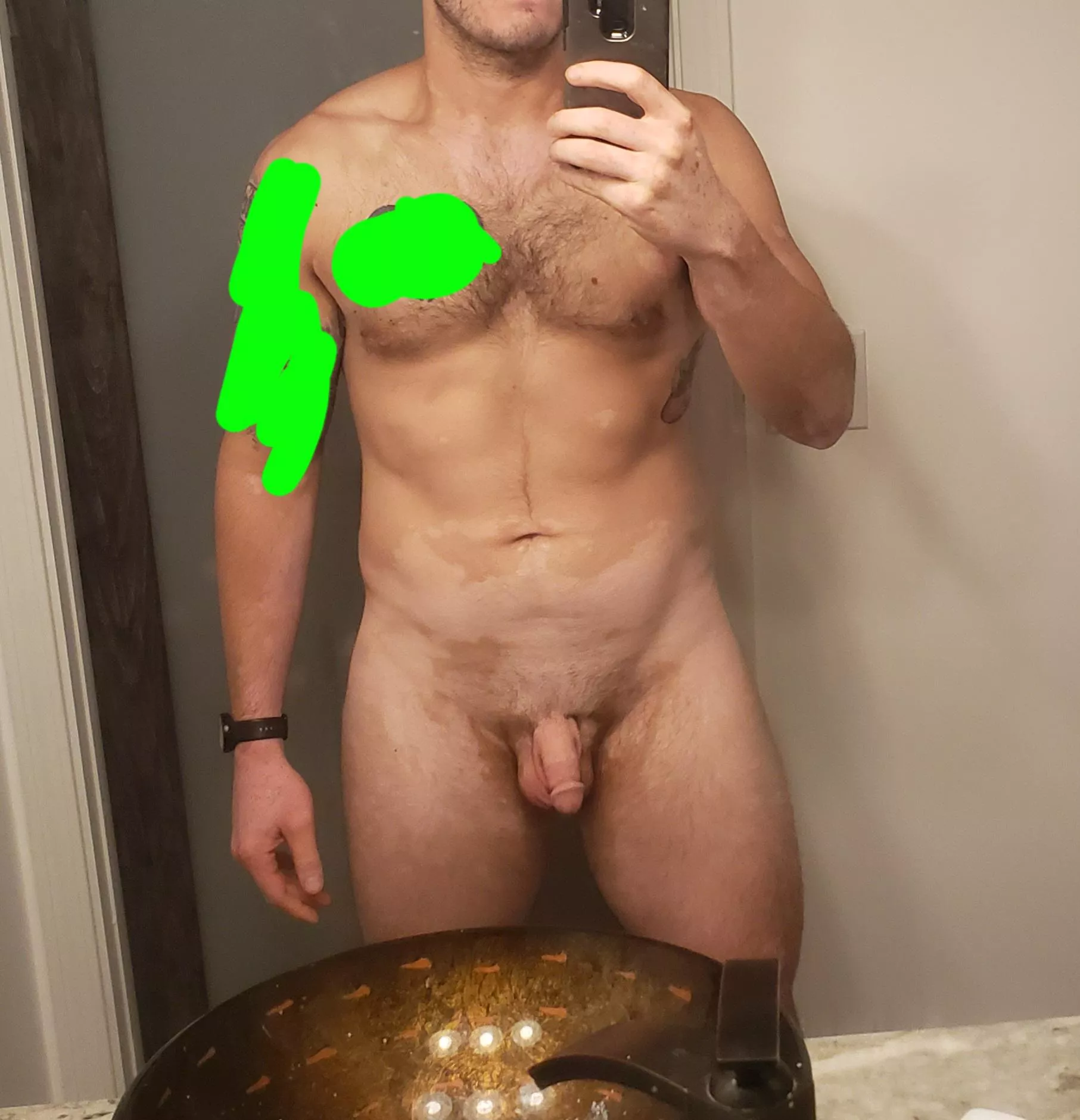 Let (m)e know? Vitiligo posted by Specialist_War_3256