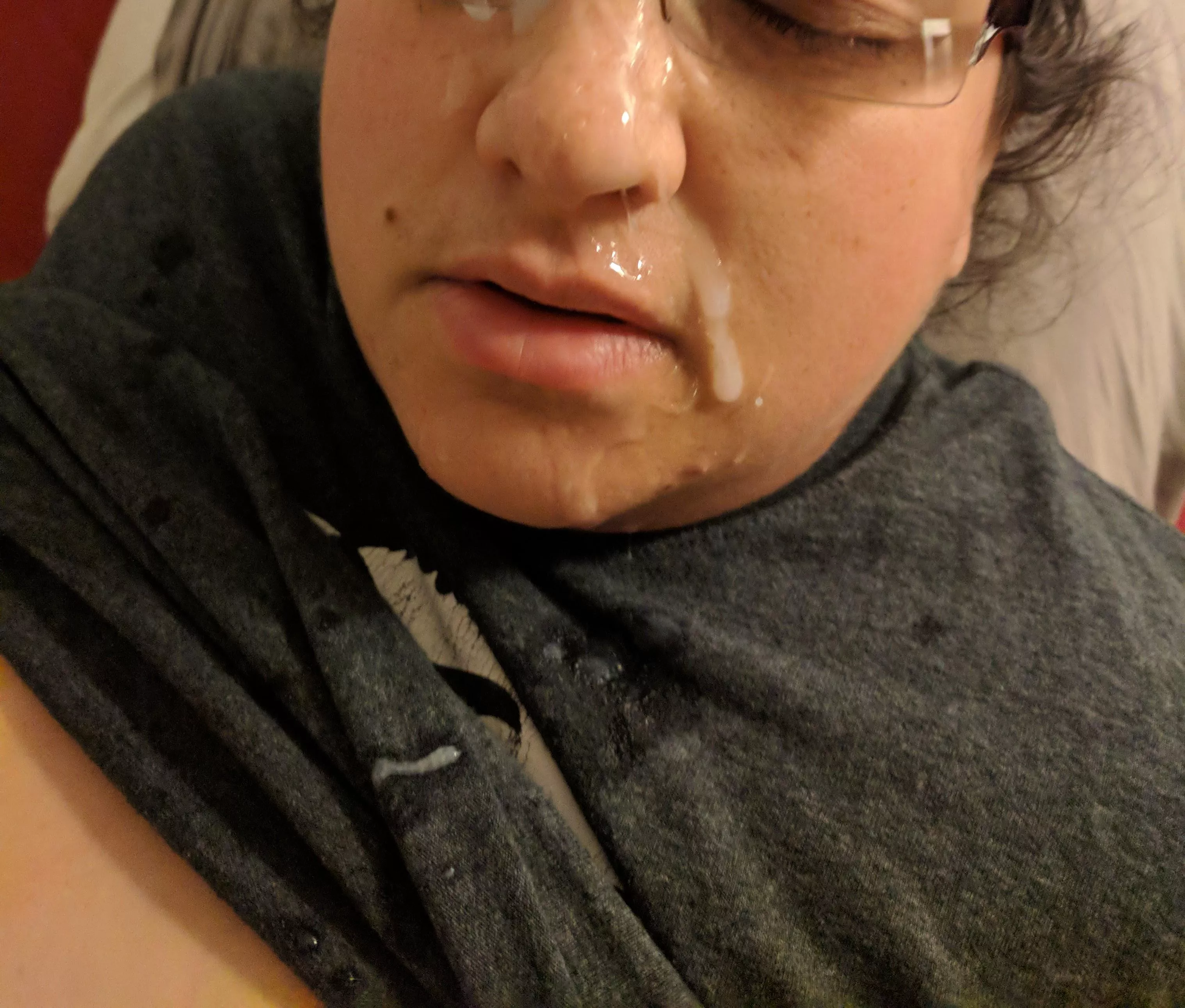 My eyes were glued shut  posted by nm8586