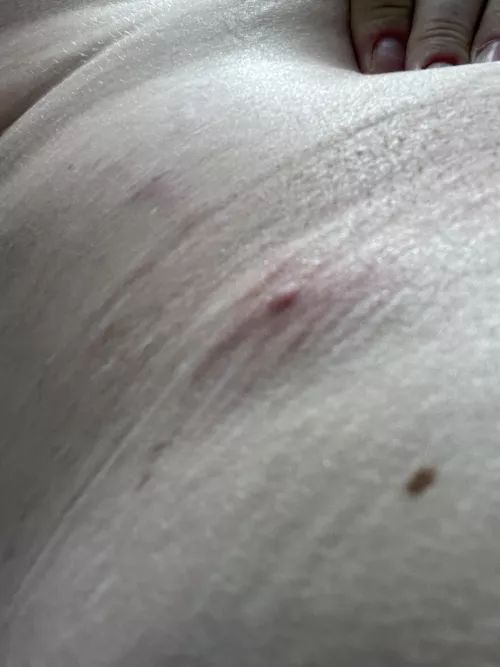 waistband monster is starting to show it's head. I wish these weren't so deep. it'd be nice to pop it and get it over with. by clezuck