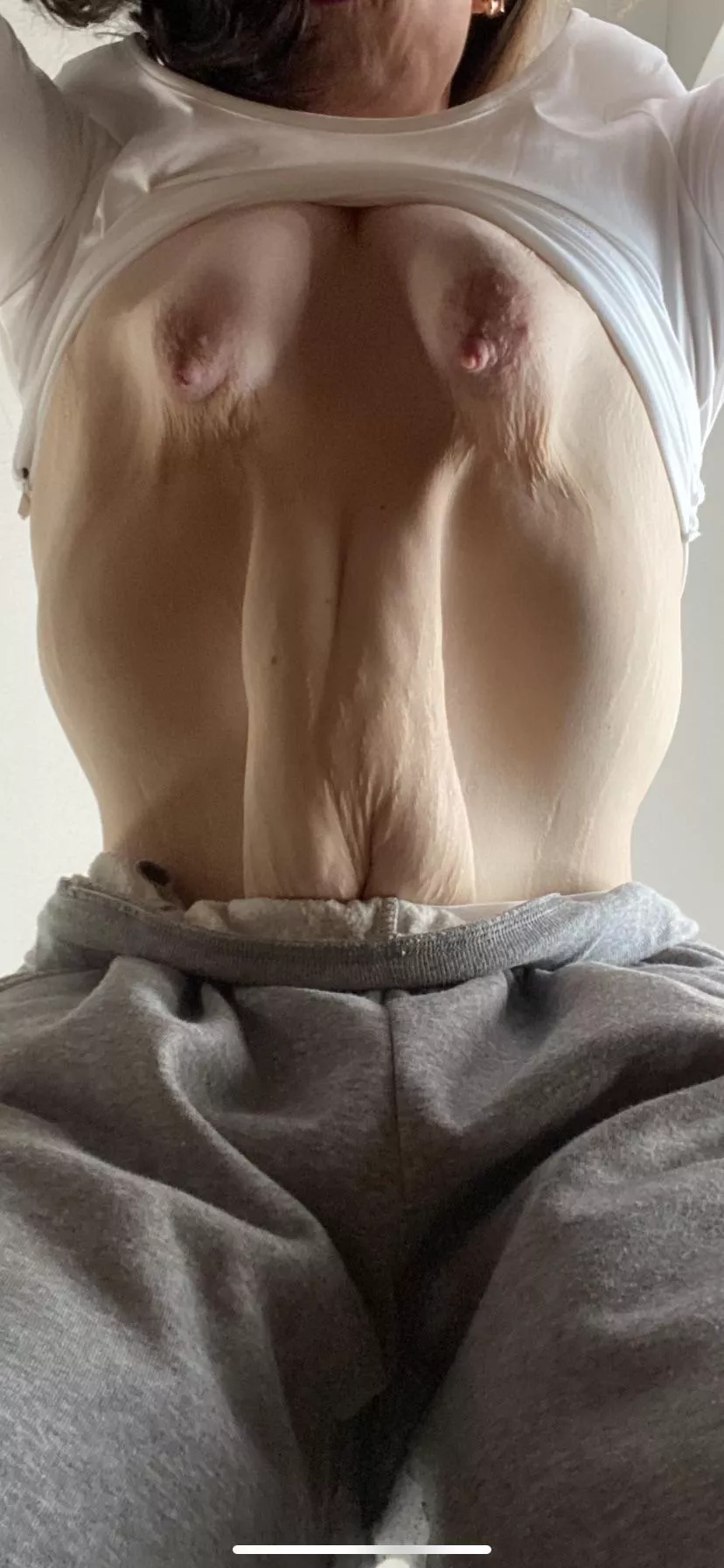 Wei boobs, weird body posted by X52101x