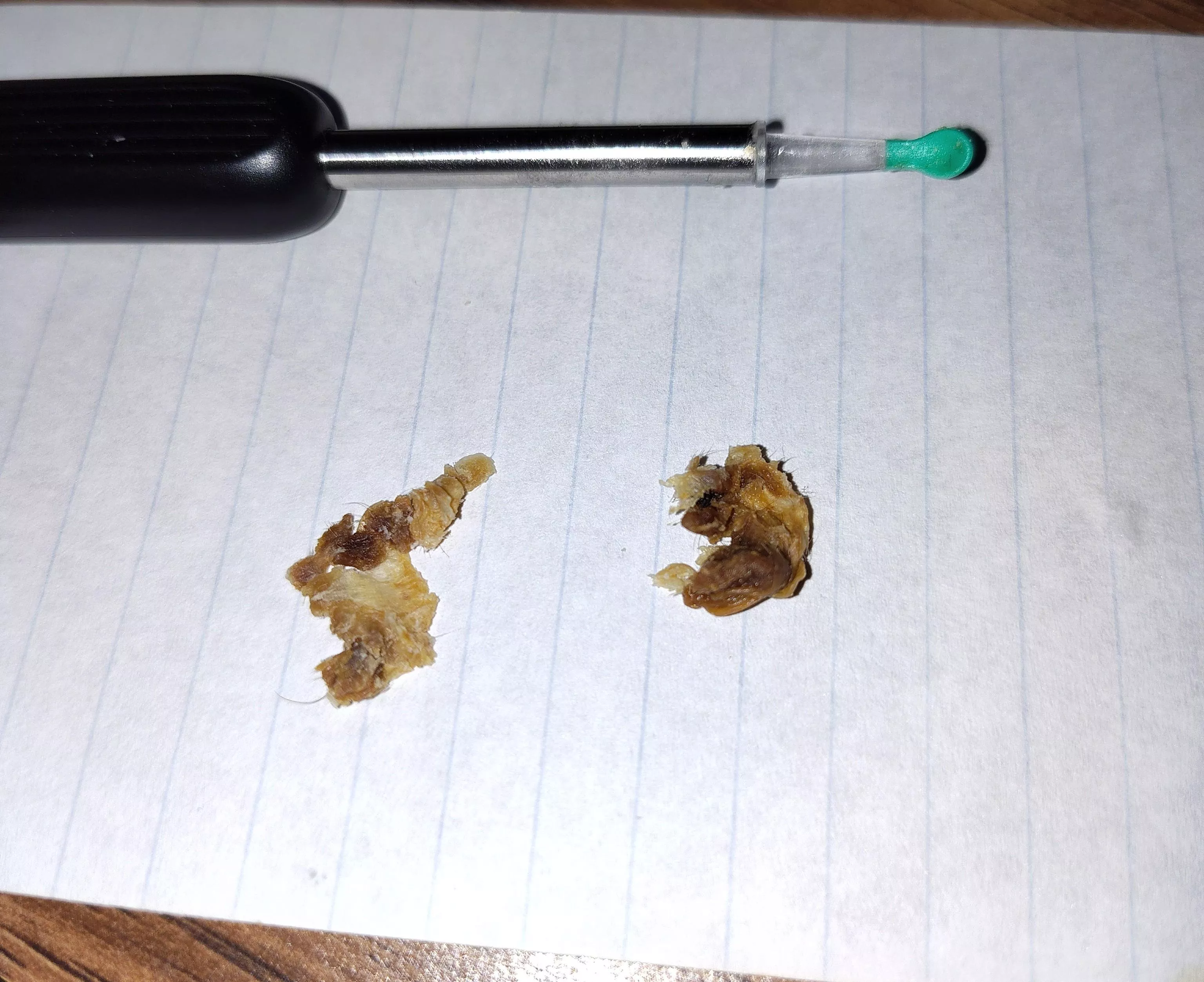 Ear gunk removed! Best $5 I have ever spent lol posted by Slippery_Molasses