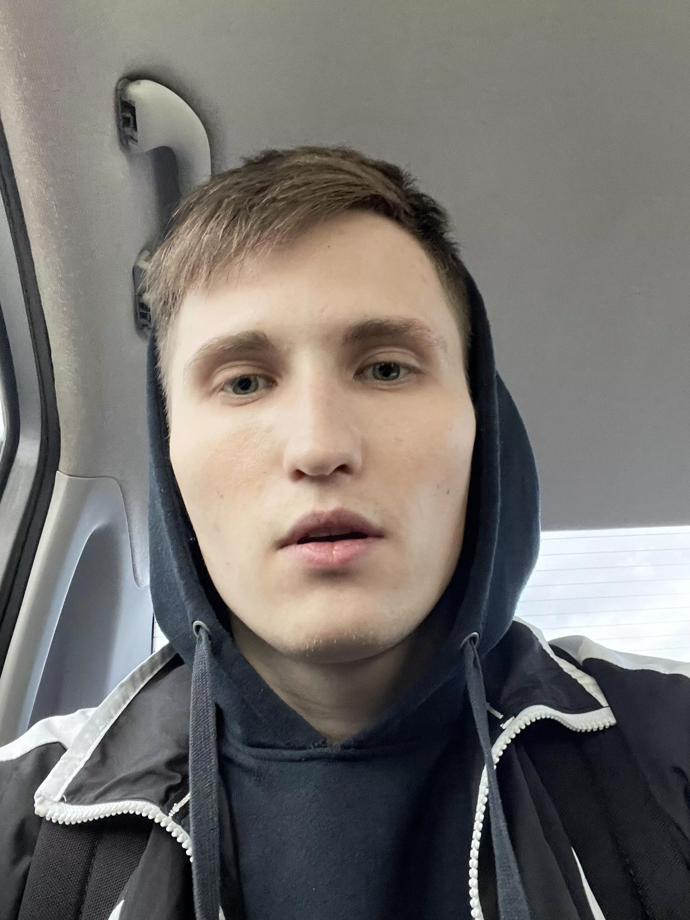 Am i ugly?) [25M] posted by kicelka1