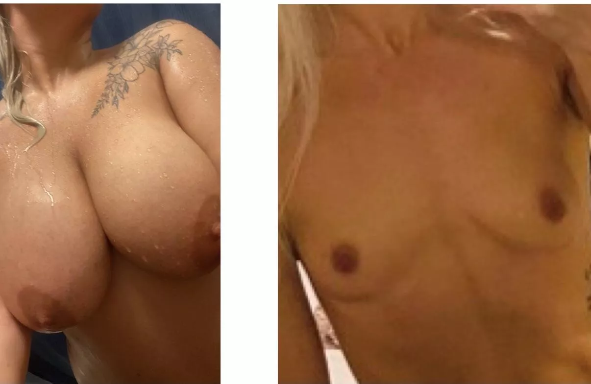 Both in DMs who you choosing posted by Asleep_University_11