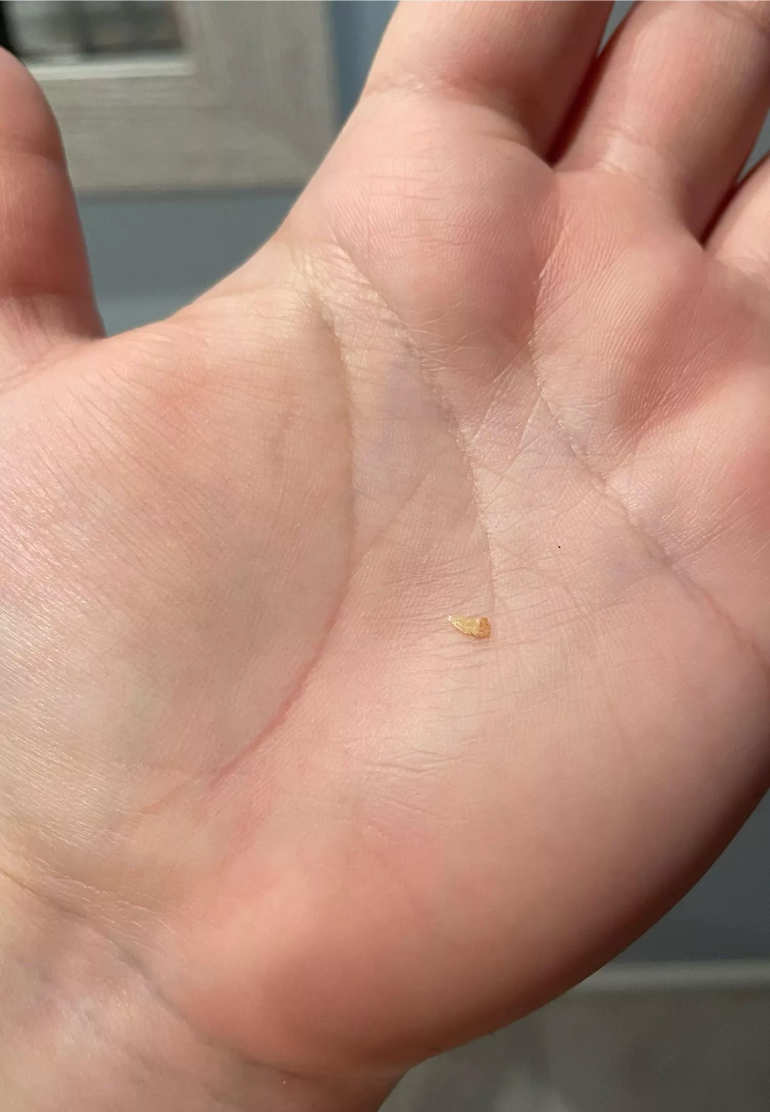 This just came out of my back posted by AstronautSad7964