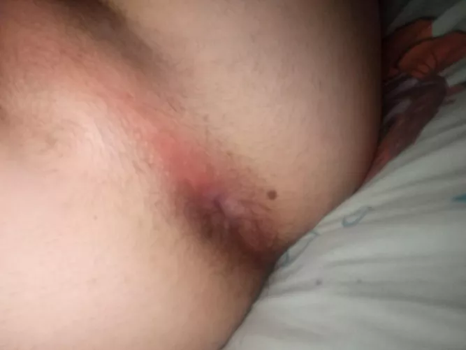 What would u do? by Various_Cap_4083