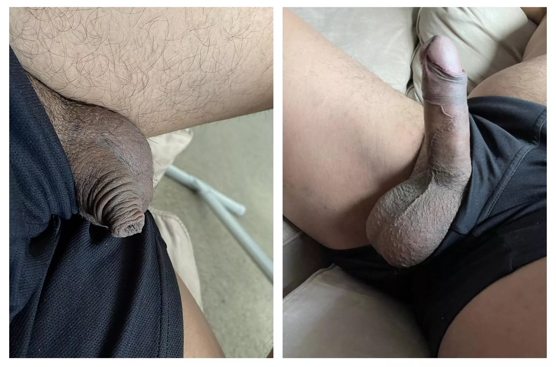 When I'm soft I'm just foreskin. What a difference 😅 posted by bigballsjw