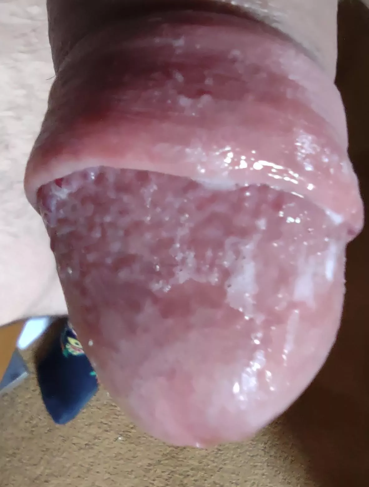 58 Wet Glans posted by Novel_Restaurant9239