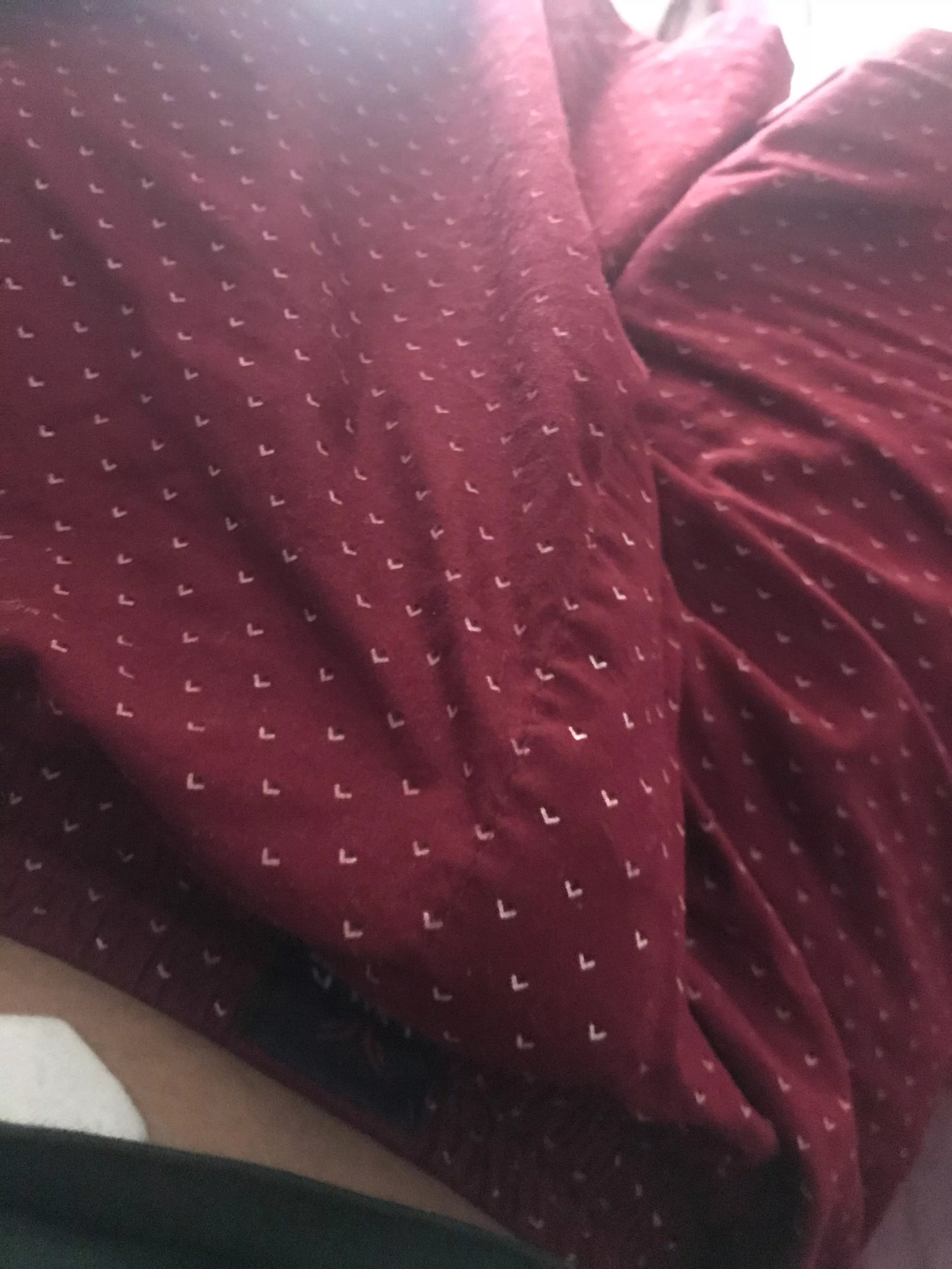 Big bulge posted by ZookeepergameWide547