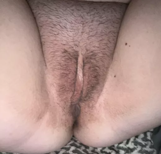 Documenting growing her back out for summer. Day 3 by funcpleAJ1117